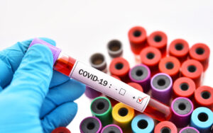 Снова о важном: как COVID-19 влияет на пациентов с продвинутой стадией ВИЧ